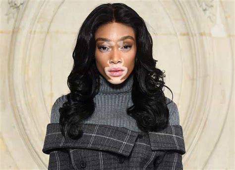 winnie harlow height and weight